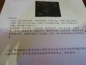 怀孕乳晕图片  第3张